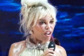 ajda-pekkanin-yuzundeki-mimiklilik-tartisma-yaratti-OR6f6X2k.jpg