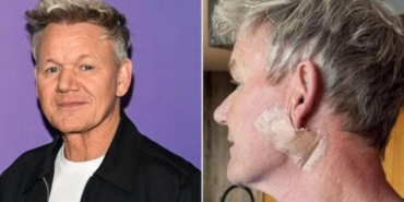 gordon-ramsay-gunes-korumasinin-onemine-dikkat-cekti-cilt-kanserine-karsi-uyari-8Ztf8mZT.jpg