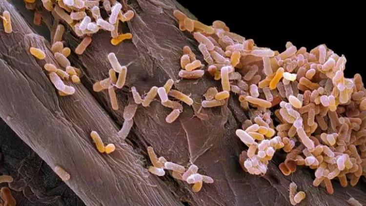 İstanbul’da tatildeki ailenin gıda zehirlenmesi şüphesi: iki çocuk hayatını kaybetti, baba yoğun bakımda